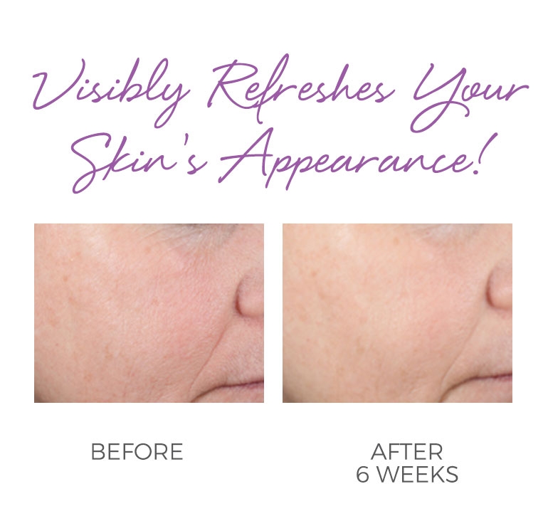 Smooth Radiance Intensive Moisturizing Serum